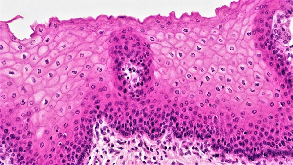 A microscopic view of stratified squamous epithelial tissue showing closely packed cellular layers.