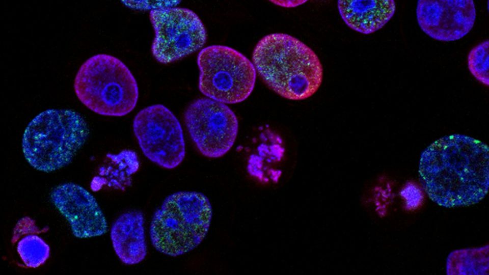 Fluorescent microscopy image of colorectal cancer cells with stained nuclei and cellular structures on a dark background.