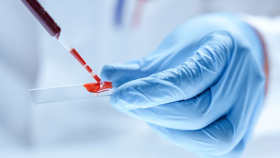 Gloved hand holding a glass slide while drops of blood are pipetted on to it.