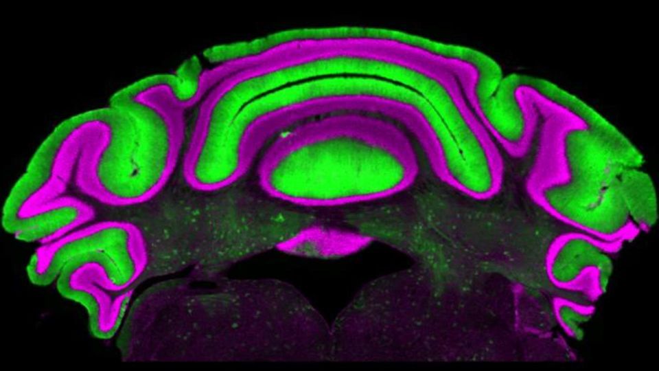 Microscopic cross-section of the cerebellum showing distinct layers containing Purkinje cells.