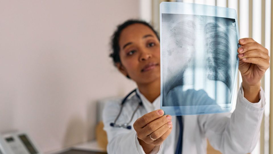 Doctor examining a chest X-ray image to assess lung health.