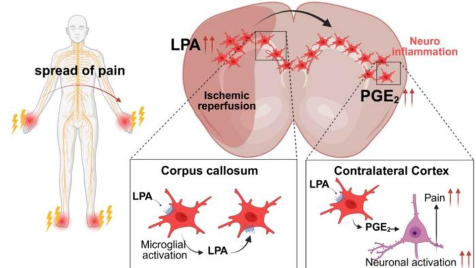 Illustration of neuroinflammation pathways showing pain spread, microglial activation, and brain signaling mechanisms.