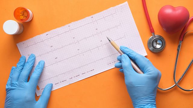 A medication container, stethoscope, and heart model, laid around an ECG on a flat orange surface. 