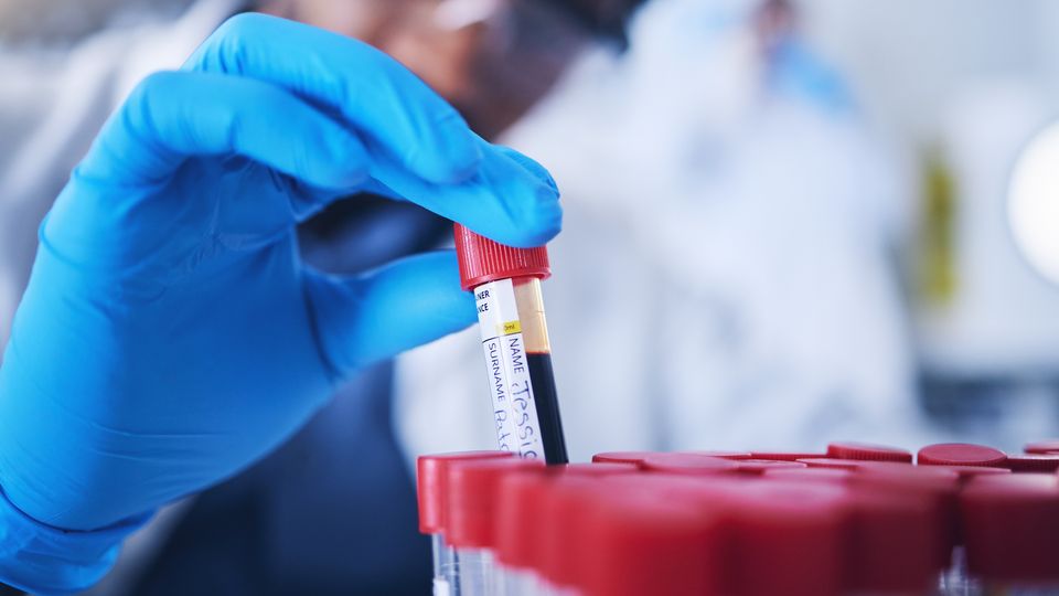 Gloved hand removing a test tube containing a blood sample from a test tube rack.