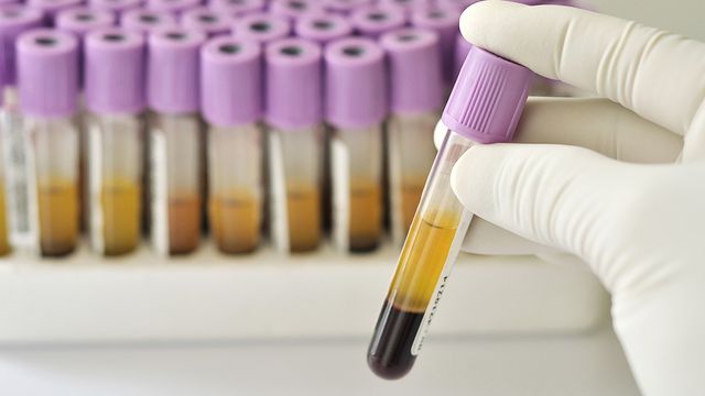 A gloved hands holds a centrifuged blood sample. 