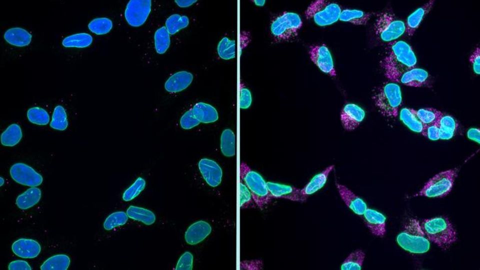 Fluorescence microscopy image of cells with stained nuclei.