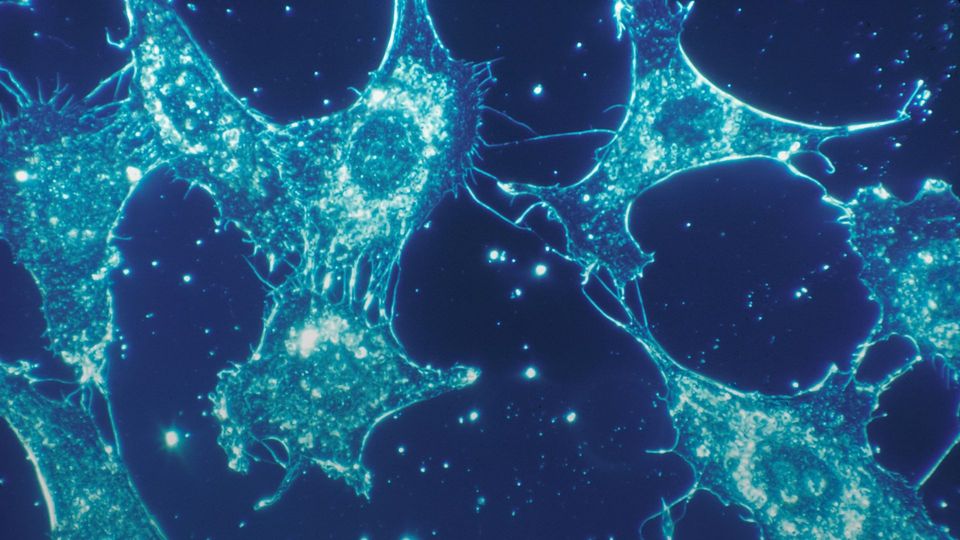 Fluorescent microscope image of connective tissue cells showing cellular structure.