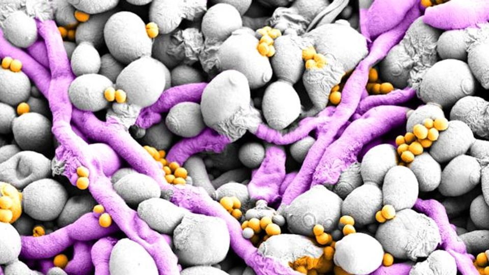 Microscopic image of Candida albicans interacting with Staphylococcus bacteria.