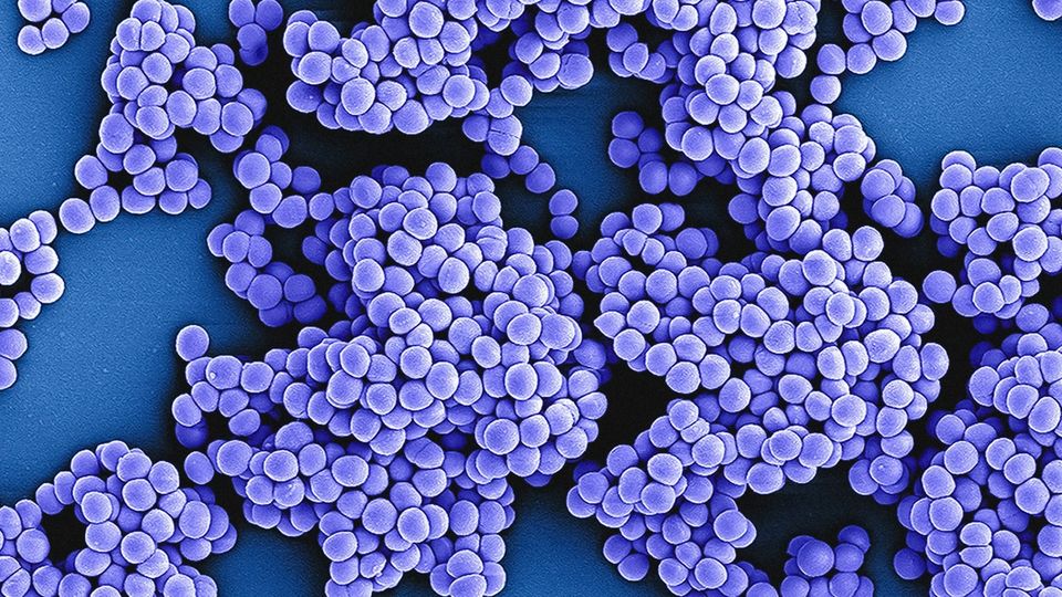 Colorized electron microscope image of bacteria clustered on a surface.