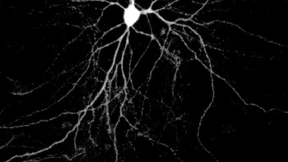 A neuron in a dish expressing human Tau protein.