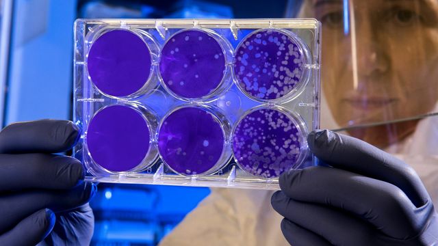 Researcher examining a multiwell culture plate with microbial colonies. 