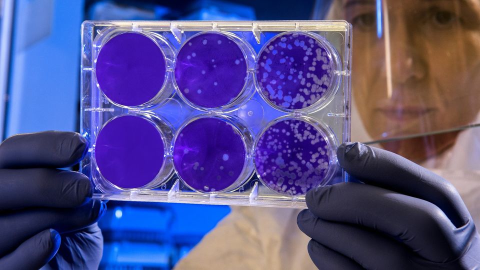 Researcher examining a multiwell culture plate with microbial colonies.