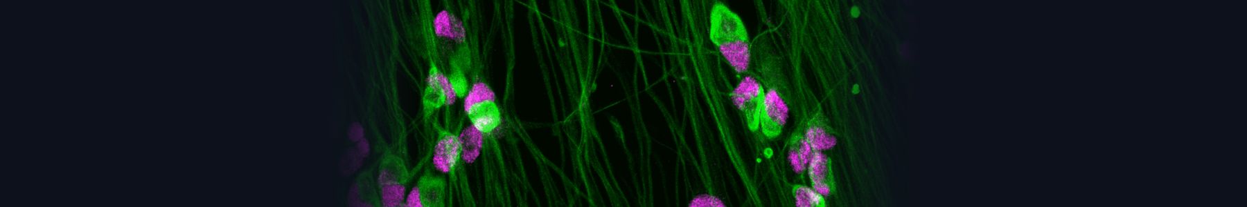 Fluorescent microscopy of neurons for neuroscience research 