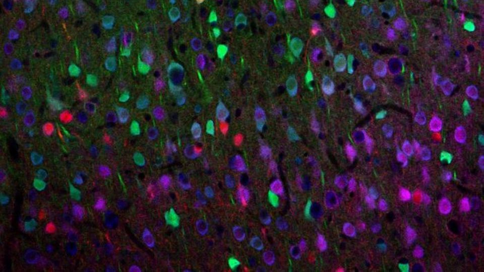 Fluorescent microscopy image showing a neuron population with multicolored stained brain cells.