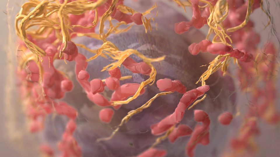 3D illustration of a melanoma cell with surrounding blood vessels.
