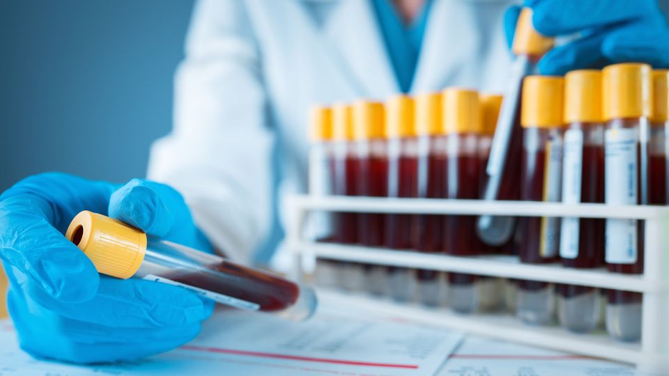 Gloved hand of a scientist holding a blood collection cube next to a rack holding several tubes.