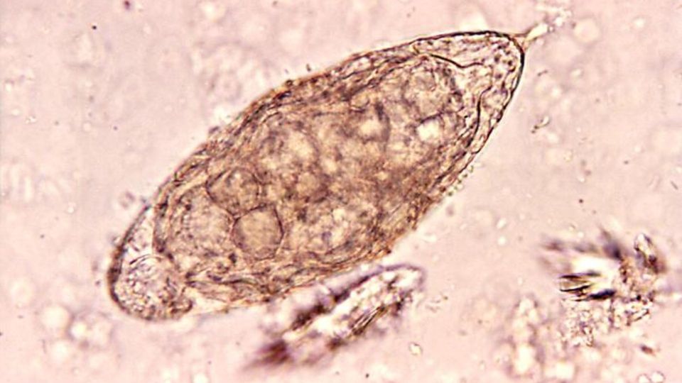 Microscopic view of a trematode parasite egg showing its oval shape and internal structure.