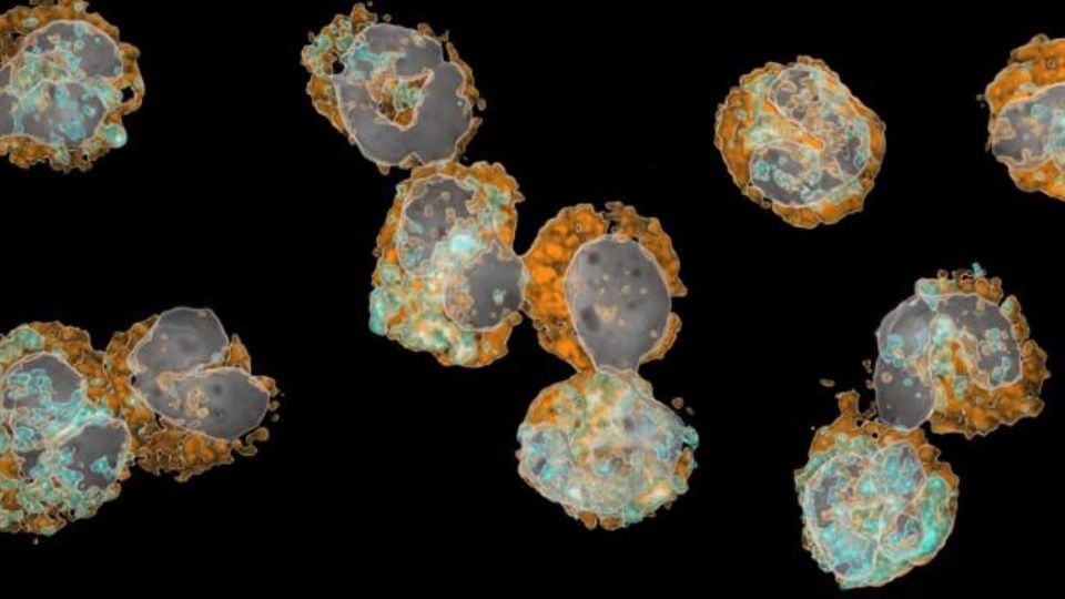 Microscopic image of neutrophil granulocytes and white blood cells.
