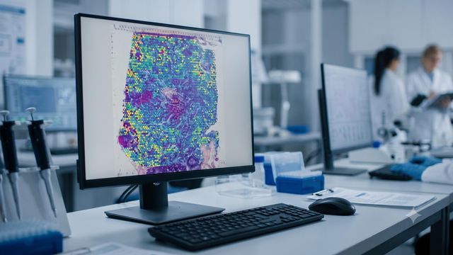 AI Methods for Spatial Transcriptomics Data Analysis | Technology Networks