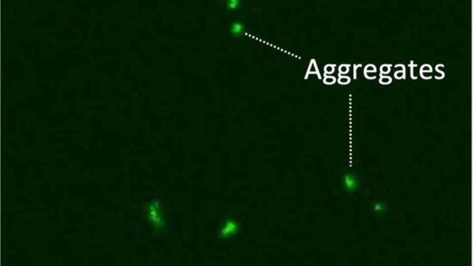 Fluorescence microscopy image showing aggregated triolein droplets labeled as aggregates against a dark background.
