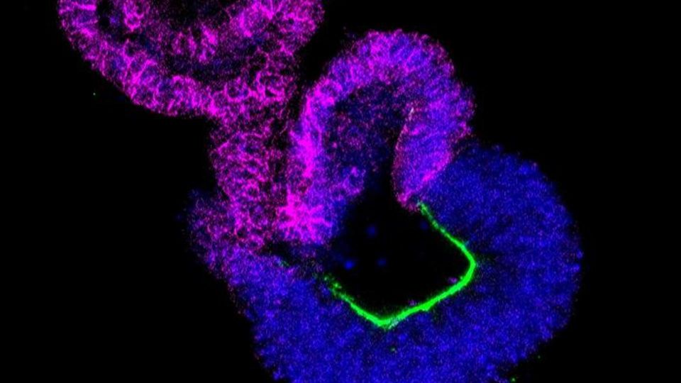 Fluorescent neural tube organoid showing developing neural tissue.