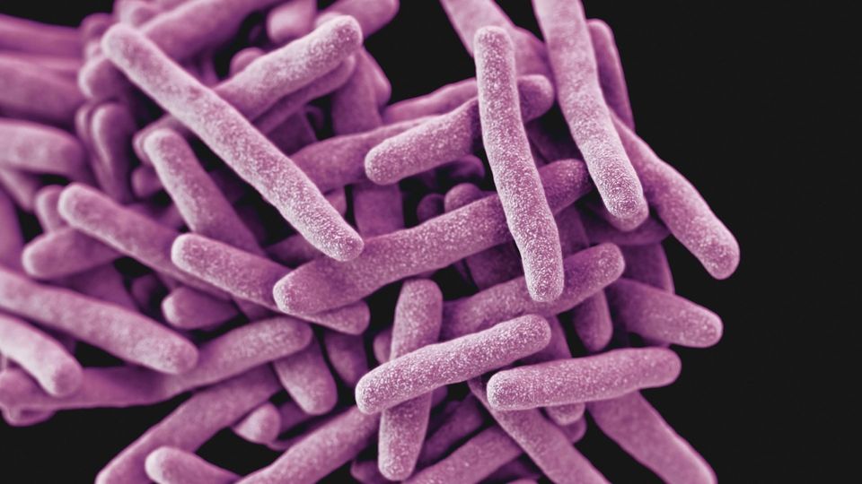 Microscopic illustration of Mycobacterium tuberculosis bacteria, showing purple rod-shapes against a black background.
