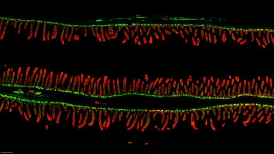 Fluorescence microscopy image of gut bacteria lining the intestinal wall.