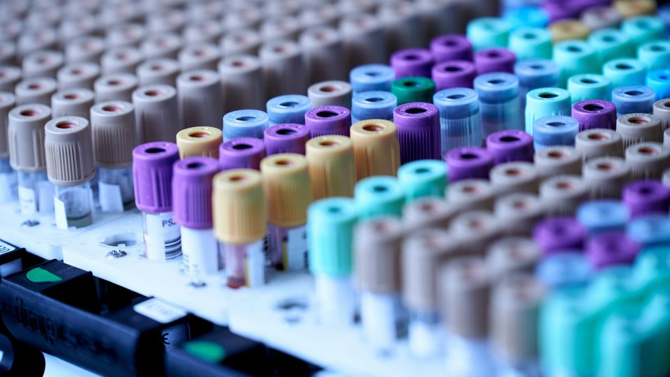Color-coded sample tubes arranged in laboratory racks.