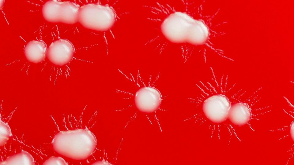 Bacterial colonies growing on red blood agar culture plate.