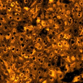Histology image showing liver tissue for predicting drug-induced liver injury with greater confidence.