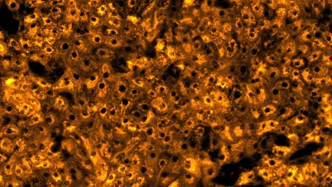 Histology image showing liver tissue for predicting drug-induced liver injury with greater confidence.