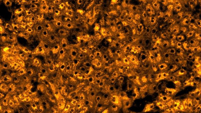 Histology image showing liver tissue for predicting drug-induced liver injury with greater confidence. 