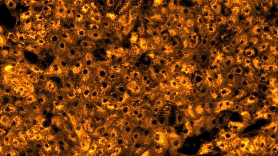 Histology image showing liver tissue for predicting drug-induced liver injury with greater confidence.