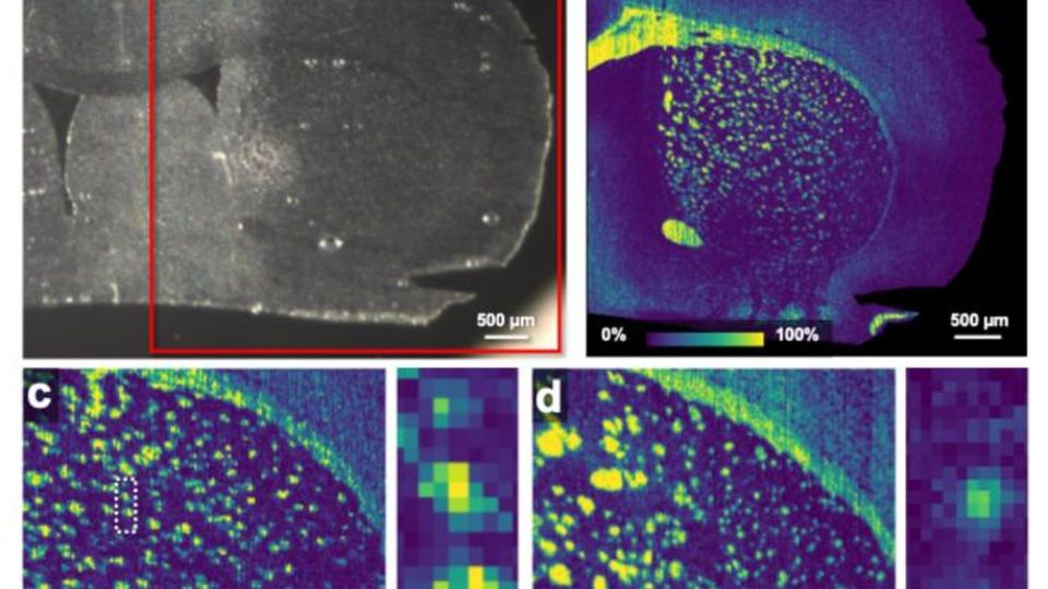 Mouse brain imaging scans comparing structural and fluorescence maps.