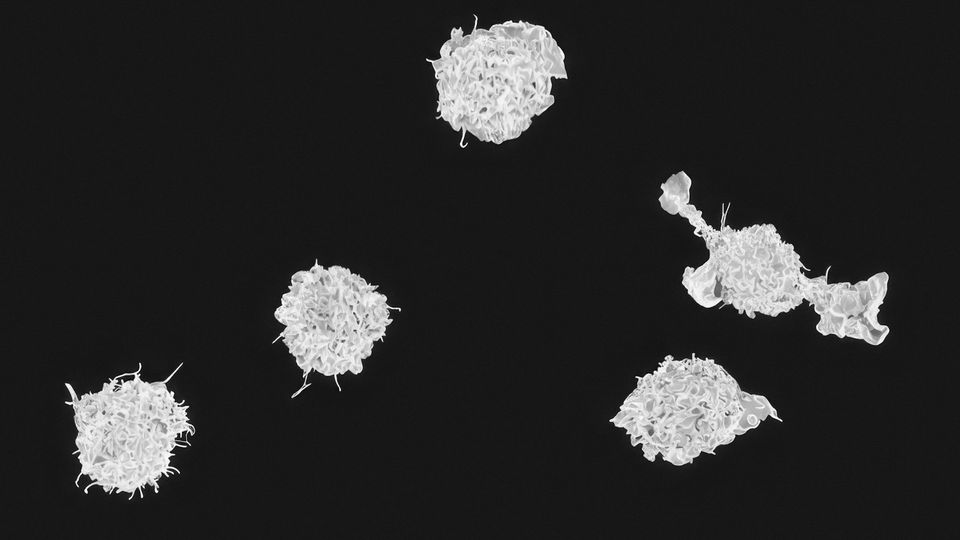Scanning electron microscope image of a macrophage colony.