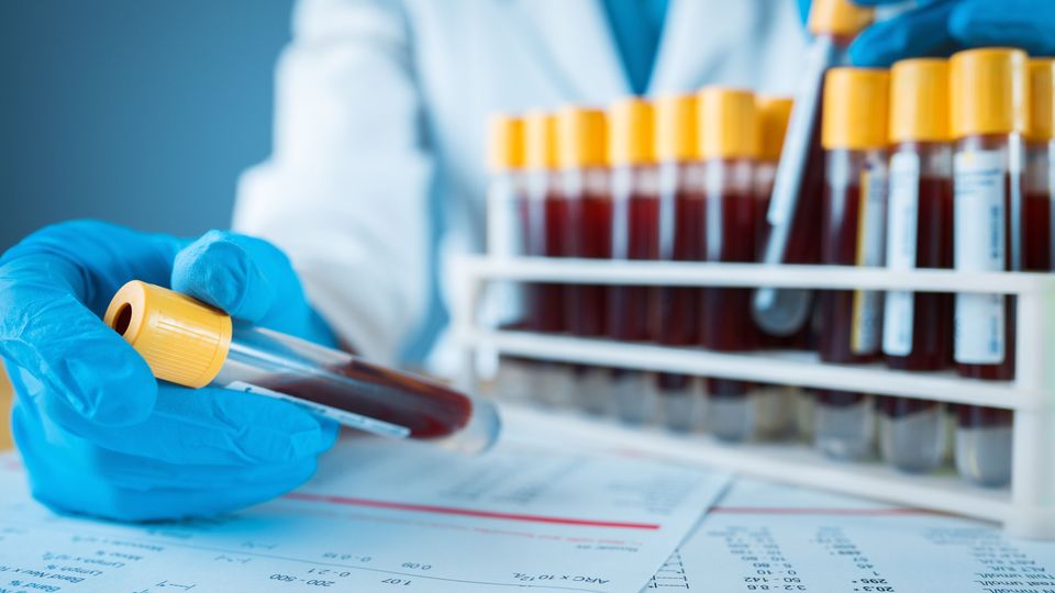 Gloved hand of a scientist holding a blood collection cube next to a rack holding several tubes.