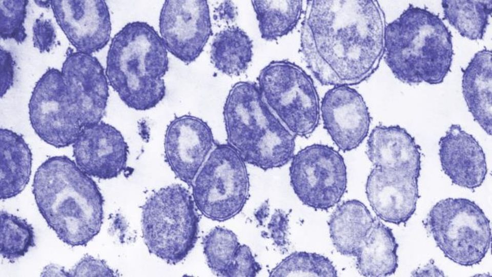 Electron microscope image of diplococcal bacteria showing paired spherical cells.