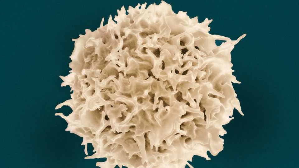 Scanning electron microscope image of a T-cell visualized in white against a dark background.