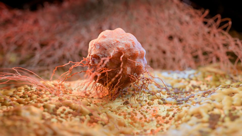 3D render of a cancer cell with branching projections invading surrounding tissue-like structures.