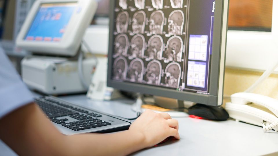 Clinician reviewing brain imaging scans on a computer monitor in a medical workstation.