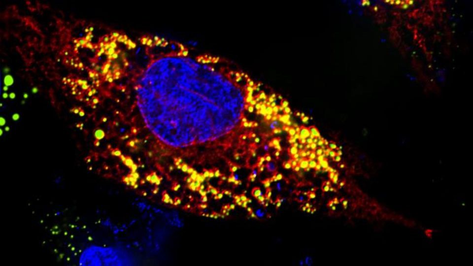 Fluorescent microscopy image of a cell infected with Zika virus.