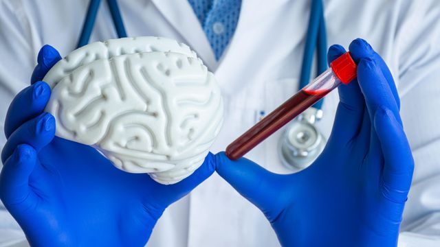 Doctor wearing blue gloves holding up a model of the human brain and a test tube containing a blood sample. 