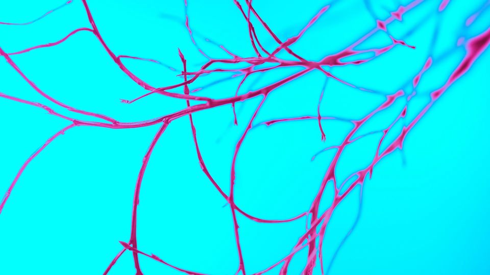 Red branch-like structures against a blue background.