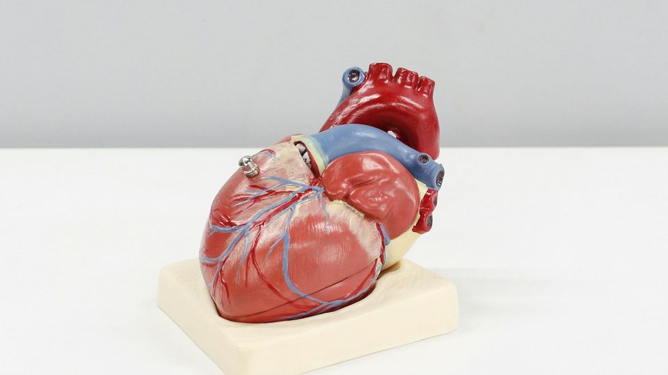 Anatomical heart model showing major blood vessels and cardiac anatomy.