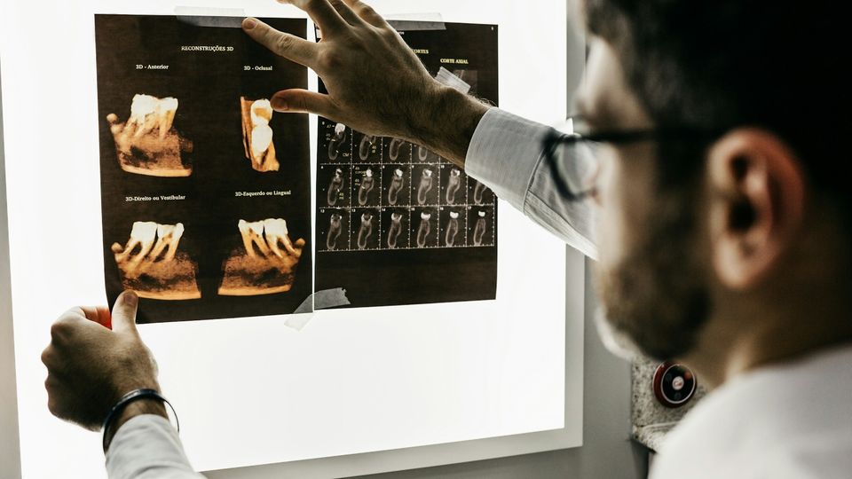 Dentist reviewing an X-ray of teeth on a lightbox.