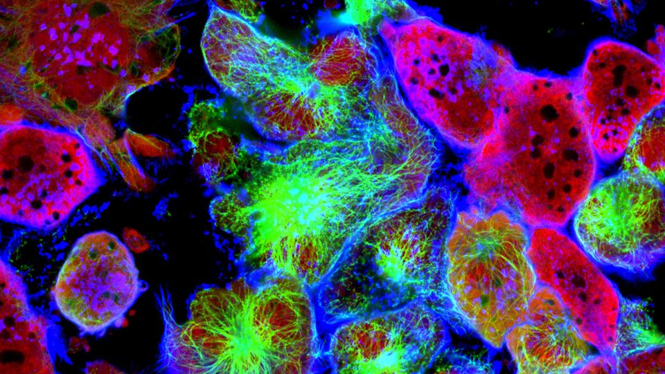 Fluorescent cancer cells. The cells are stained green, blue, red and pink and are on a black background.