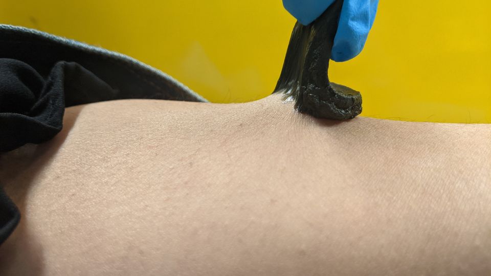 A researcher in a blue glove peeling an adhesive biosensor away from a person's skin.