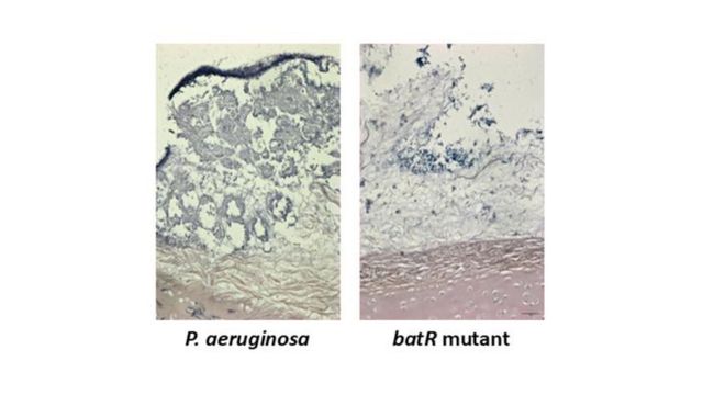 Biofilm Discovery May Improve Infection Treatments - News Directory 3