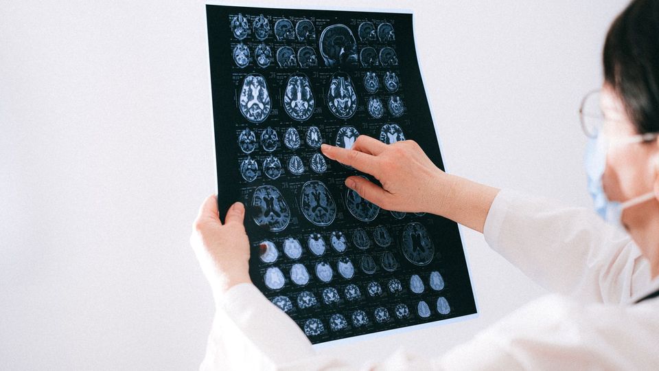 A clinician points to a brain scan.
