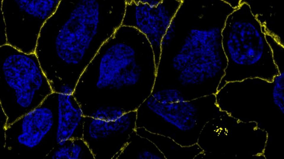 Fluorescent microscopy image of gut epithelial cells.